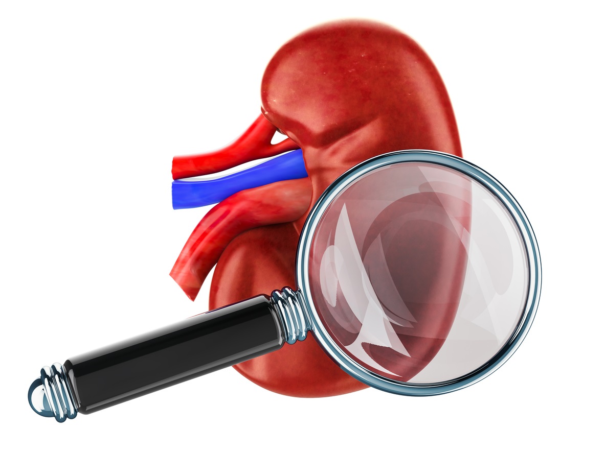 NMN Protects Against DNA Damage Related Kidney Scarring nmn-protects-against-dna-damage-related-kidney-scarring