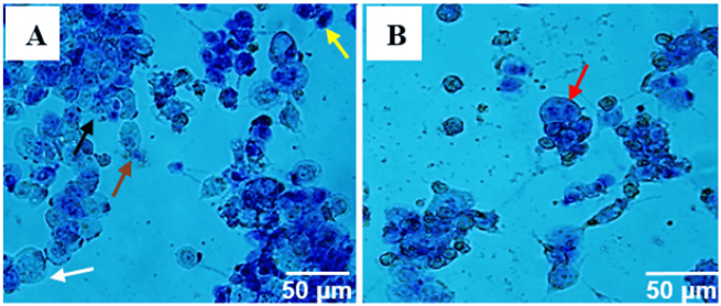 Berberine treatments induce cellular markers of apoptosis in colorectal cancer cells. A) Cell swelling (white arrow), apoptotic bodies (brown arrow), ruptured cell membrane (black arrow), and DNA packaging condensation (yellow arrow, chromatin condensation) are observed. B) Cell nucleus fragmentation is indicated by the red arrow.