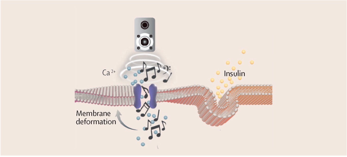 Famous Queen track rocks insulin cells into action