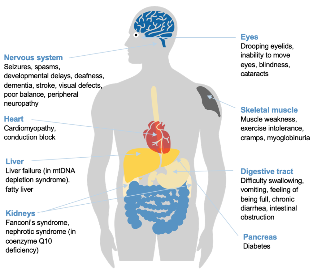 I diagram of a body with the different organ systems affected by mitochondrial disease. 