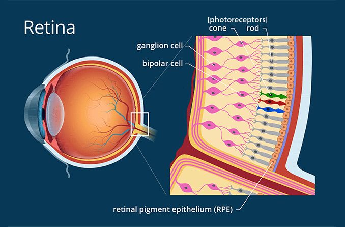 A diagram of the side-profile of an eye showing a yellow line surrounding the back of the eye. Zoomed into the yellow line is another diagram of the various cells of the retina. 