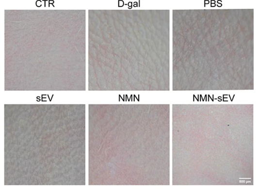 NMN-loaded vesicles prevent age-related skin wrinkling.