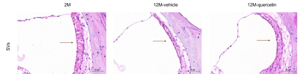 Images of the cochlear damage seen in mice with hearing loss being mitigated by quercetin