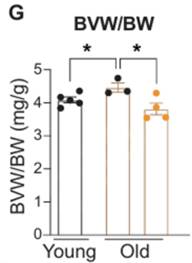 NR treatment prevents age-related cardiac enlargement.