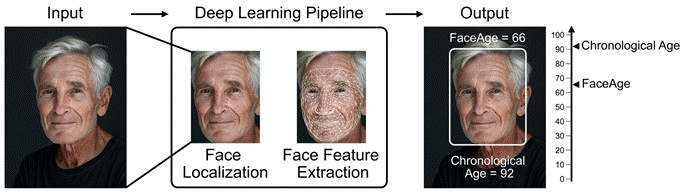 FaceAge involves using a facial photograph, analyzing it in an AI deep learning pipeline, calculating a FaceAge biological age score, and comparing that score to chronological age.
