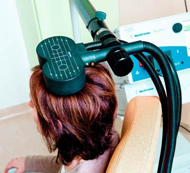 Repetitive transcranial magnetic stimulation (rTMS) entails placing an electromagnetic coil against the scalp, which delivers magnetic pulses.